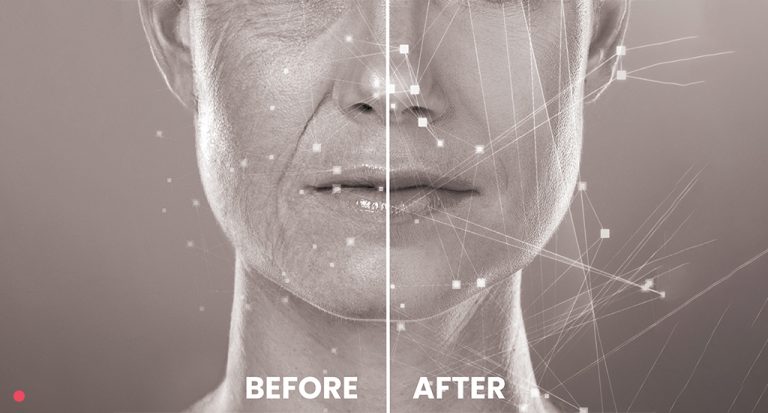 5 Reasons Why Before-and-After Photos Build Trust in the Beauty Industry
