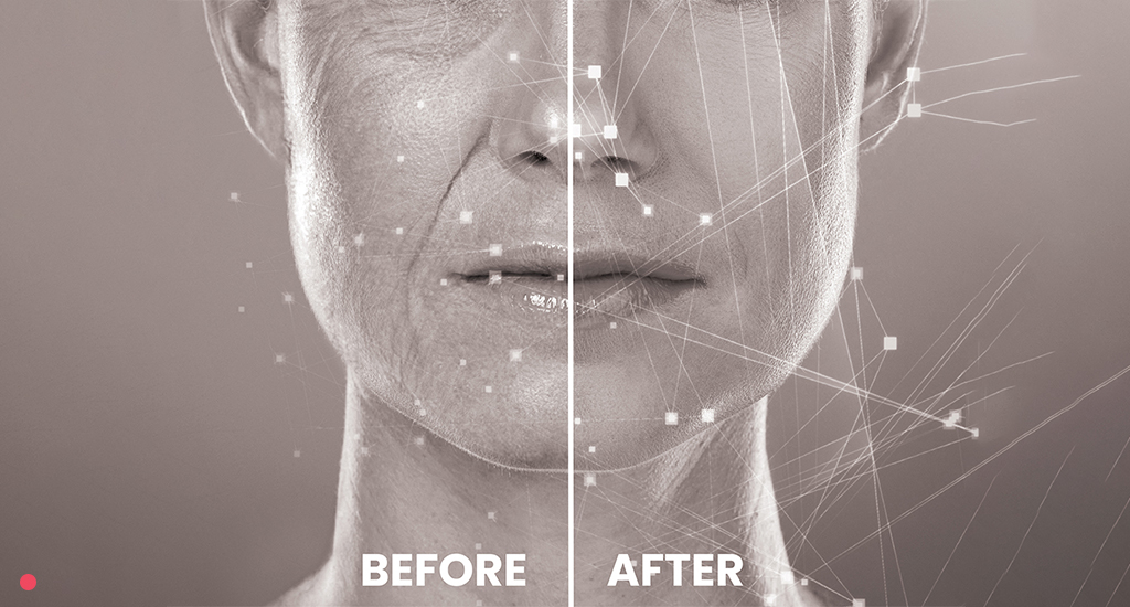 5 Reasons Why Before-and-After Photos Build Trust in the Beauty Industry